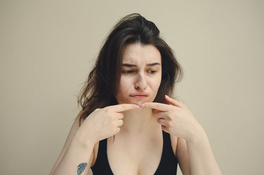 Acné de l'Adulte  Le Plan d'Attaque Intégral pour Éliminer les Boutons (Hormones, Alimentation et Peau)