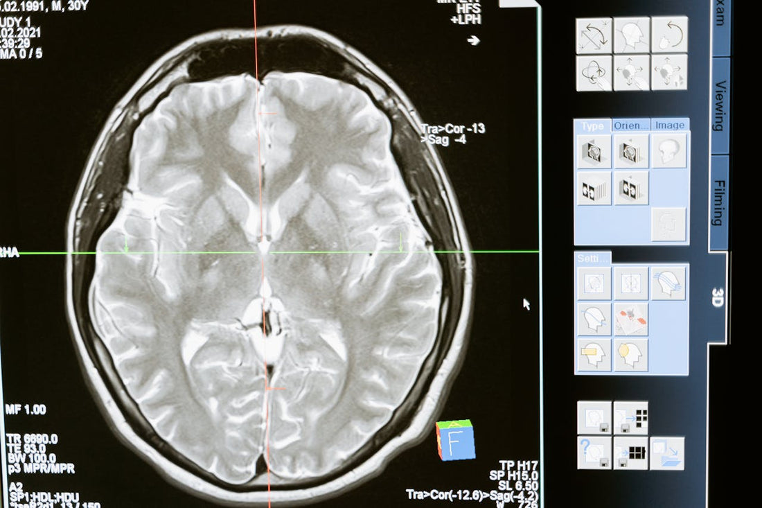 Concentration Zénith  Les 5 Aliments et Rituels pour un Cerveau Performant