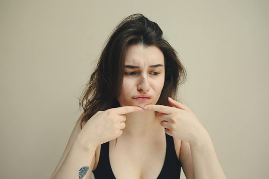 Adieu à l'acné : Comment une approche naturelle peut transformer votre peau ?