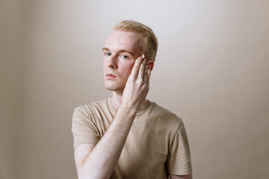 Comment se débarrasser des microkystes du visage ?