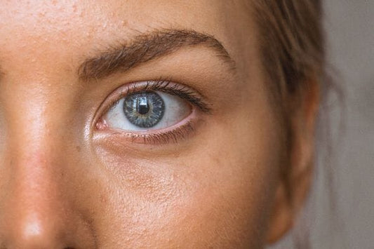 Petits boutons blancs sur le visage, comment s’en débarrasser ?